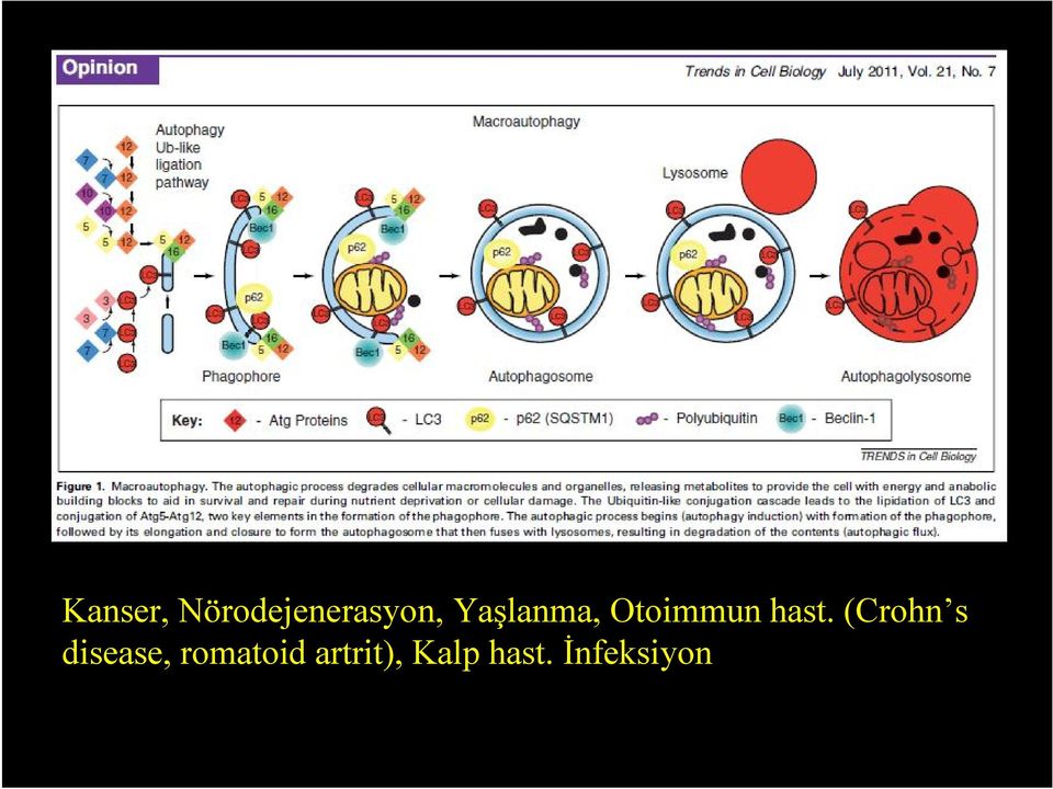 (Crohn s disease, romatoid