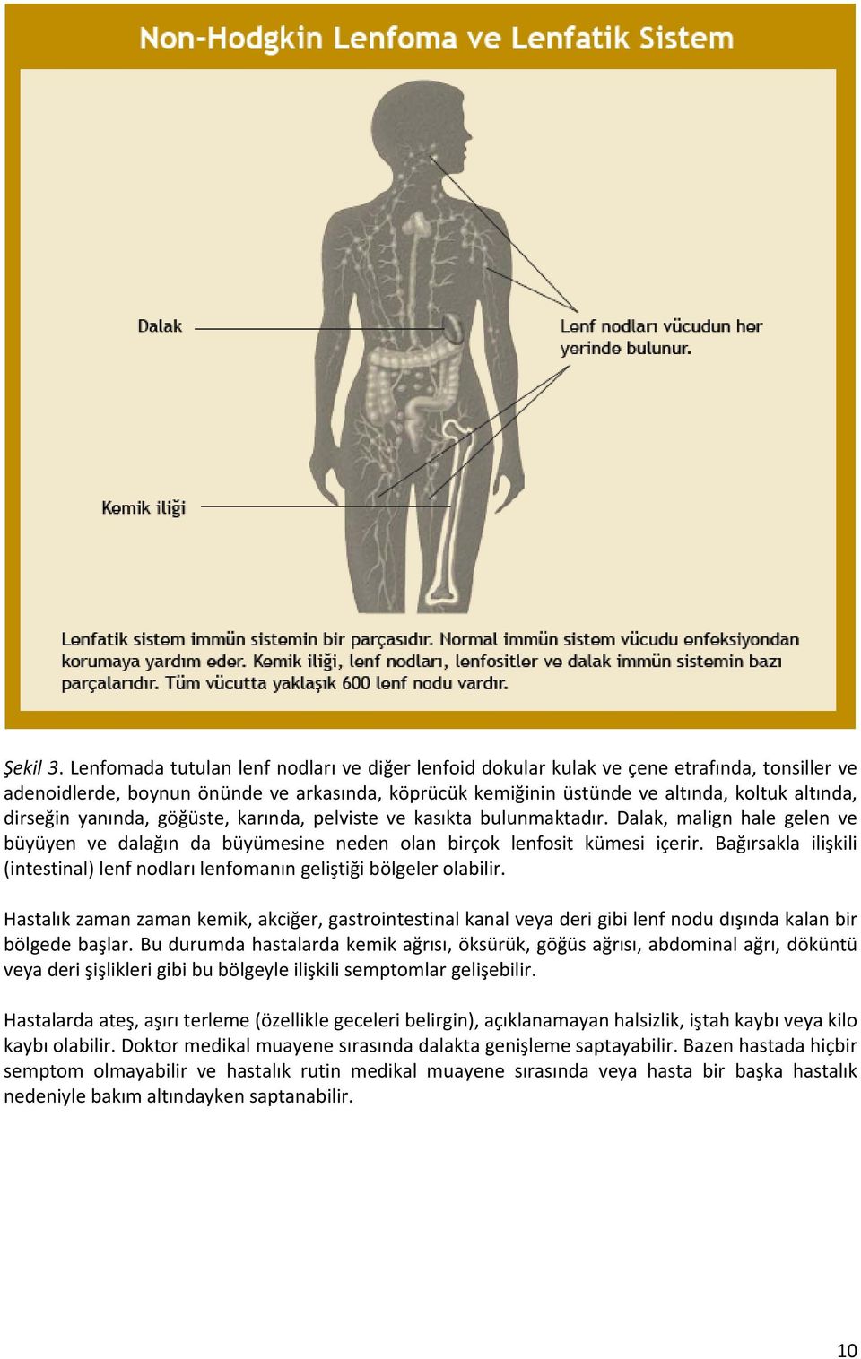 yanında, göğüste, karında, pelviste ve kasıkta bulunmaktadır. Dalak, malign hale gelen ve büyüyen ve dalağın da büyümesine neden olan birçok lenfosit kümesi içerir.