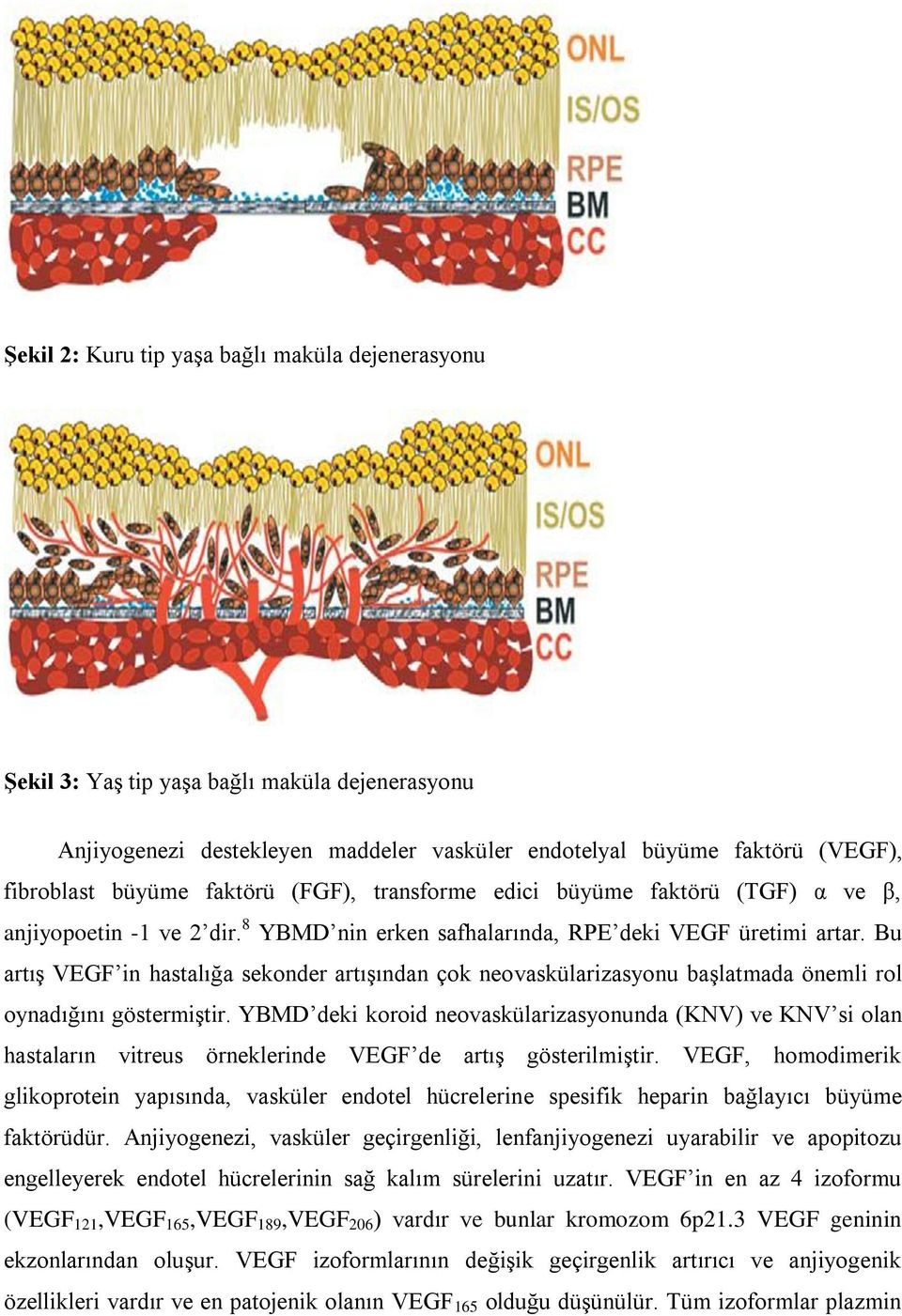 Bu artıģ VEGF in hastalığa sekonder artıģından çok neovaskülarizasyonu baģlatmada önemli rol oynadığını göstermiģtir.