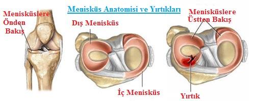 Menisküs Yırtıkları Diz vücudumuzun en büyük ve en karmaşık eklemlerden biridir. Diz birçok yapıyı içinde barındırır. Bu yapılar bazen istem dışı olarak zarar görebilir.