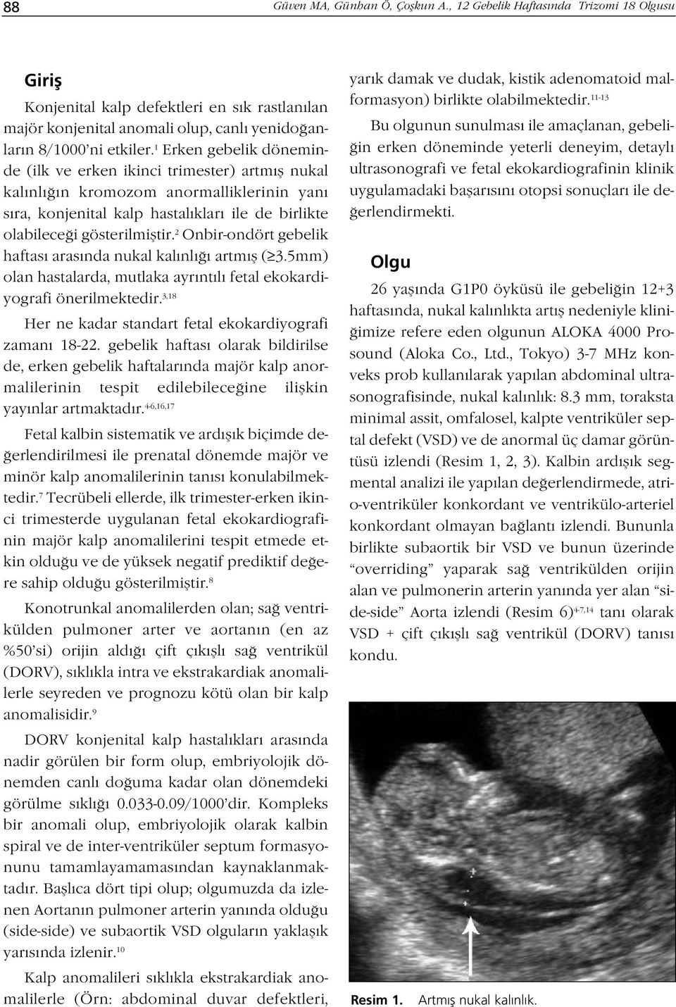 2 Onbir-ondört gebelik haftası arasında nukal kalınlı ı artmıfl ( 3.5mm) olan hastalarda, mutlaka ayrıntılı fetal ekokardiyografi önerilmektedir.
