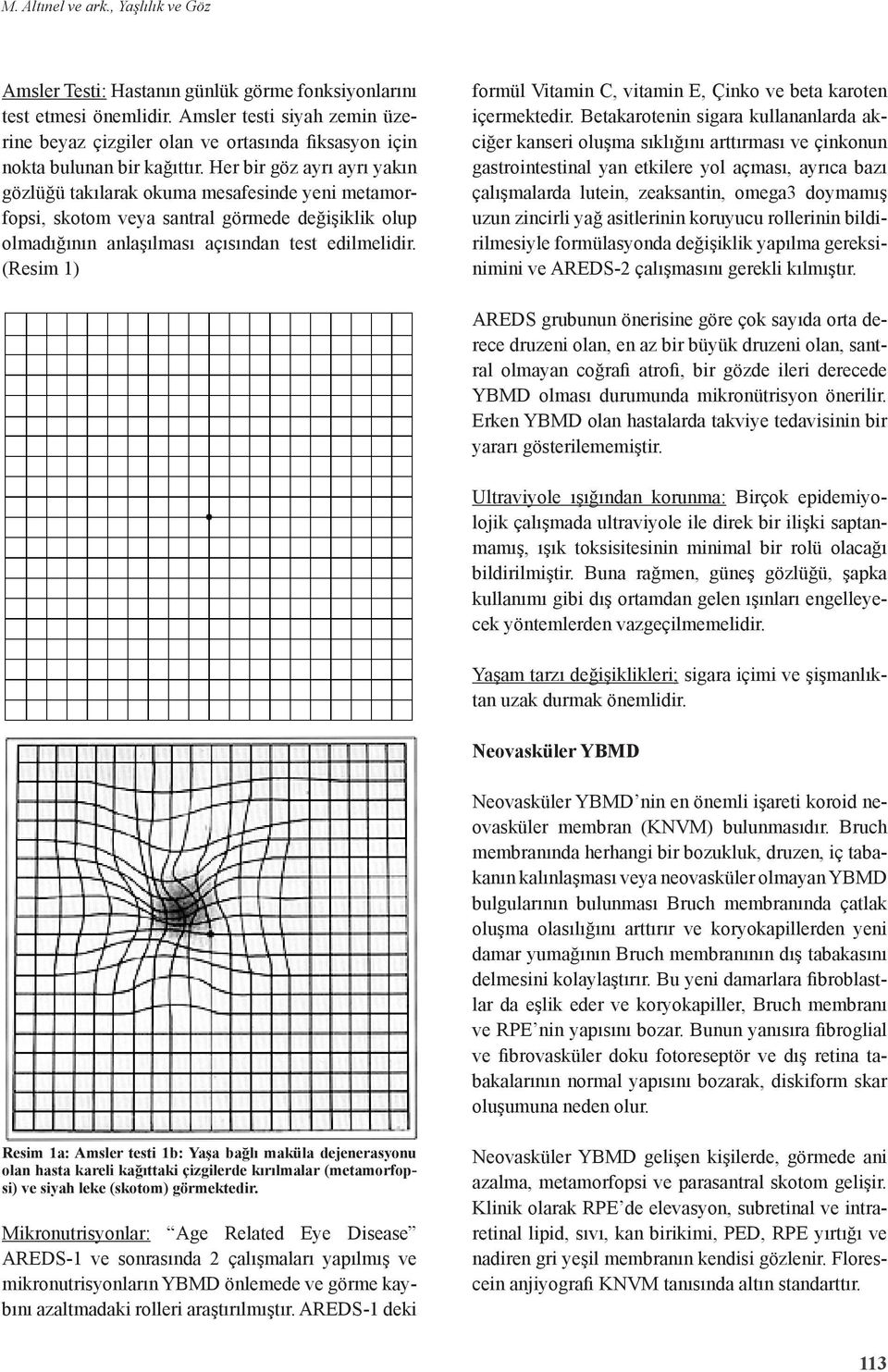 Her bir göz ayrı ayrı yakın gözlüğü takılarak okuma mesafesinde yeni metamorfopsi, skotom veya santral görmede değişiklik olup olmadığının anlaşılması açısından test edilmelidir.