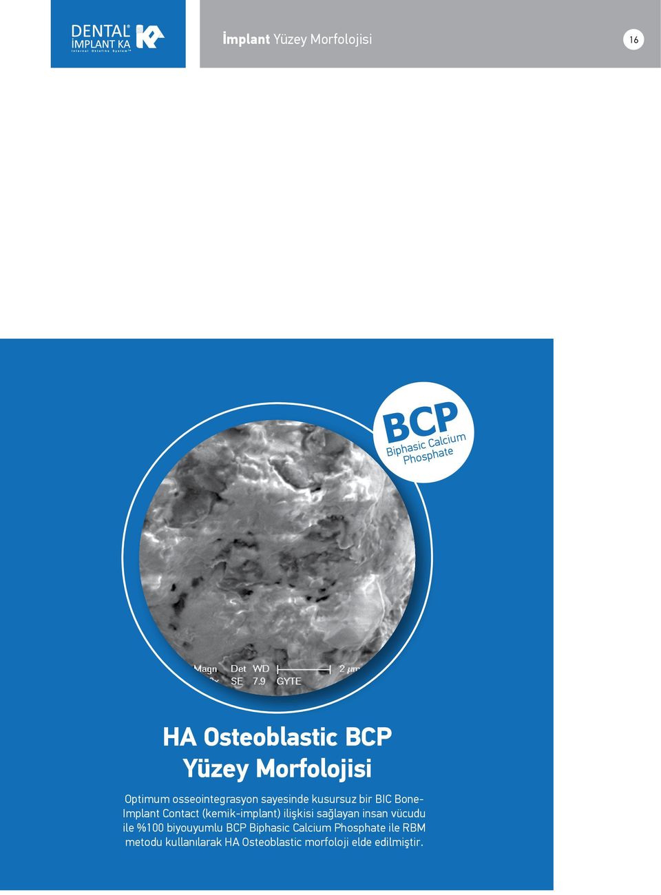 Contact (kemik-implant) ilişkisi sağlayan insan vücudu ile %100 biyouyumlu BCP