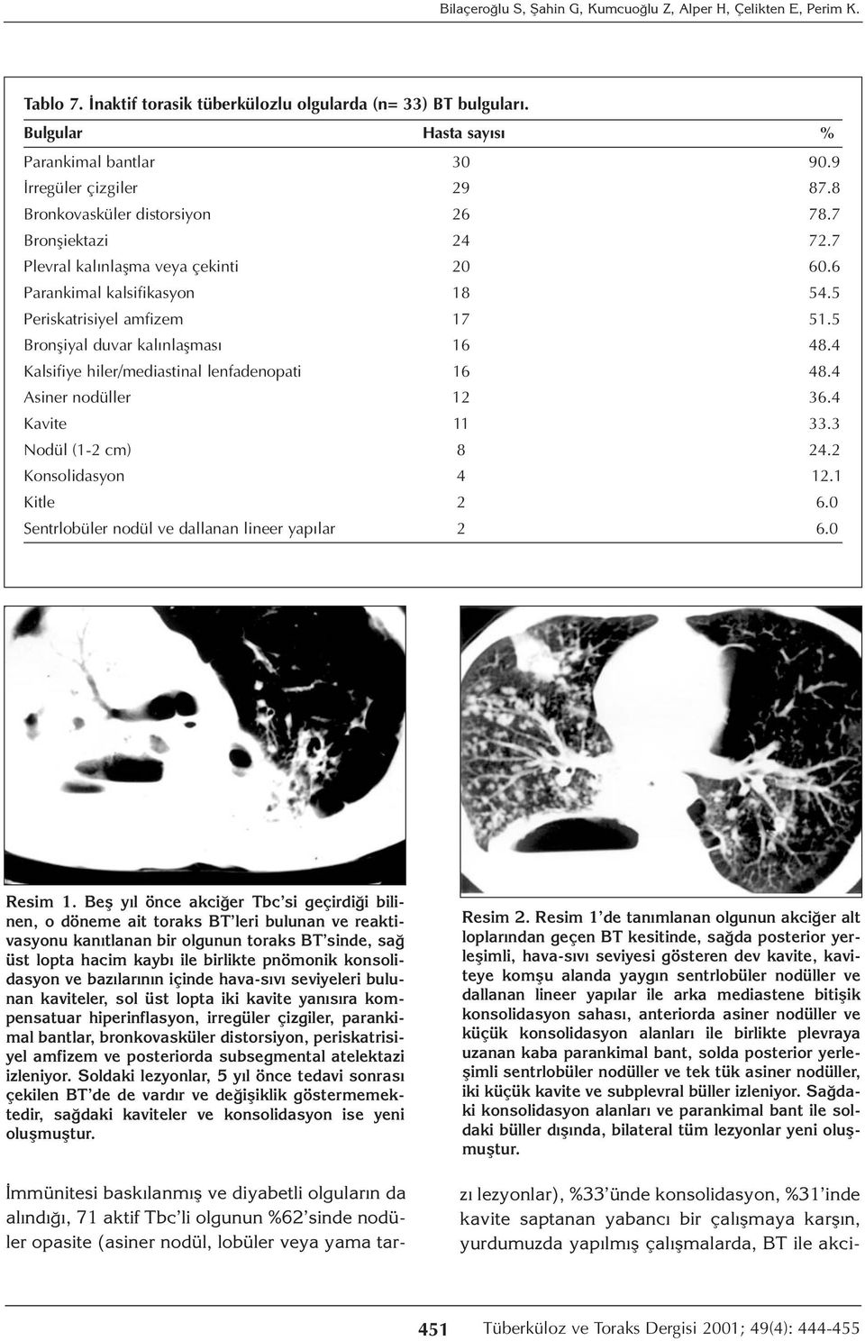 5 Bronşiyal duvar kalınlaşması 16 48.4 Kalsifiye hiler/mediastinal lenfadenopati 16 48.4 Asiner nodüller 12 36.4 Kavite 11 33.3 Nodül (1-2 cm) 8 24.2 Konsolidasyon 4 12.1 Kitle 2 6.