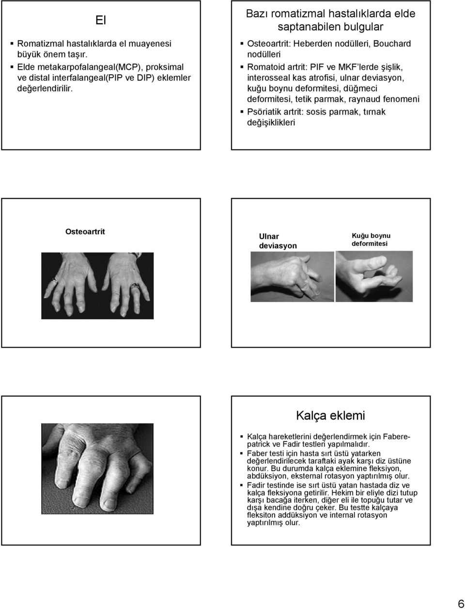 boynu deformitesi, düğmeci deformitesi, tetik parmak, raynaud fenomeni Psöriatik artrit: sosis parmak, tırnak değişiklikleri Osteoartrit Ulnar deviasyon Kuğu boynu deformitesi Kalça eklemi Kalça