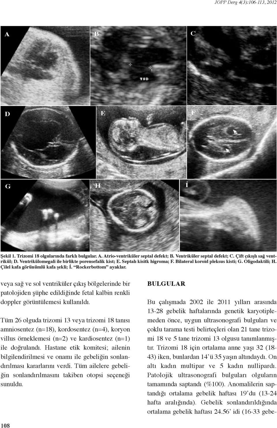 veya sağ ve sol ventriküler çıkış bölgelerinde bir patolojiden şüphe edildiğinde fetal kalbin renkli doppler görüntülemesi kullanıldı.