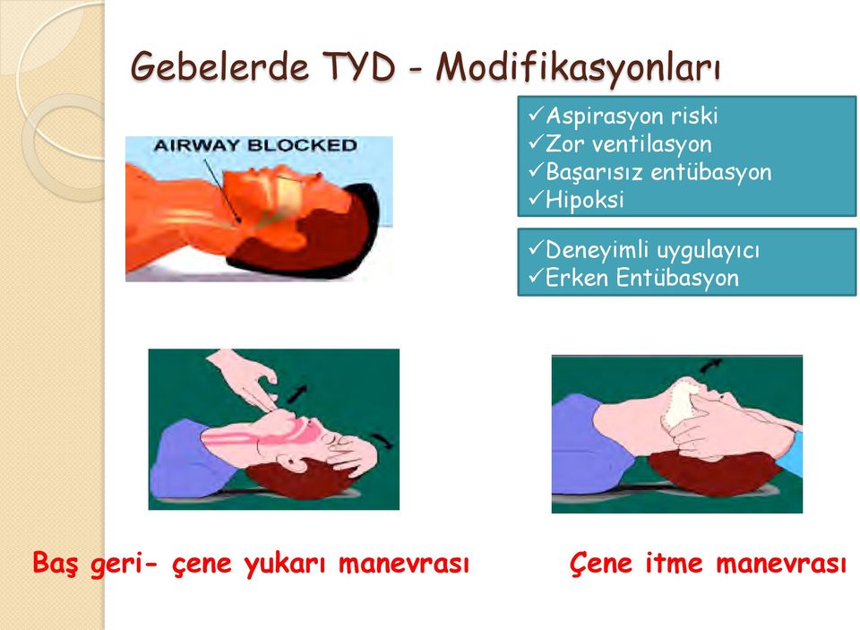 Hipoksi Deneyimli uygulayıcı Erken Entübasyon