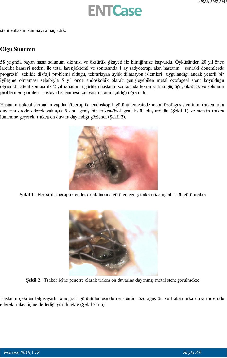 dilatasyon işlemleri uygulandığı ancak yeterli bir iyileşme olmaması sebebiyle 5 yıl önce endoskobik olarak genişleyebilen metal özofageal stent koyulduğu öğrenildi.