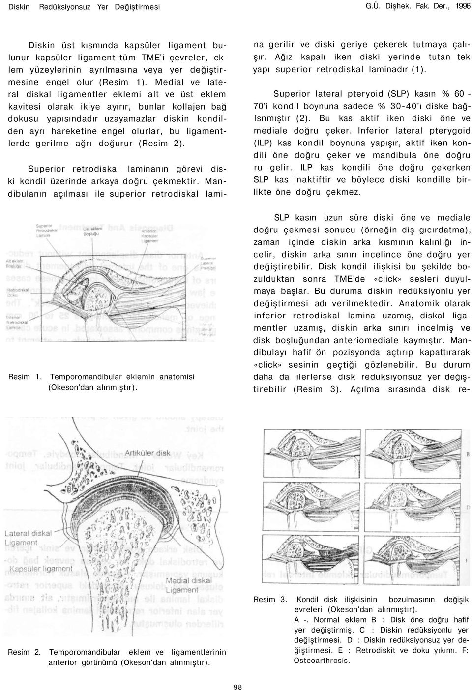 Medial ve lateral diskal ligamentler eklemi alt ve üst eklem kavitesi olarak ikiye ayırır, bunlar kollajen bağ dokusu yapısındadır uzayamazlar diskin kondilden ayrı hareketine engel olurlar, bu