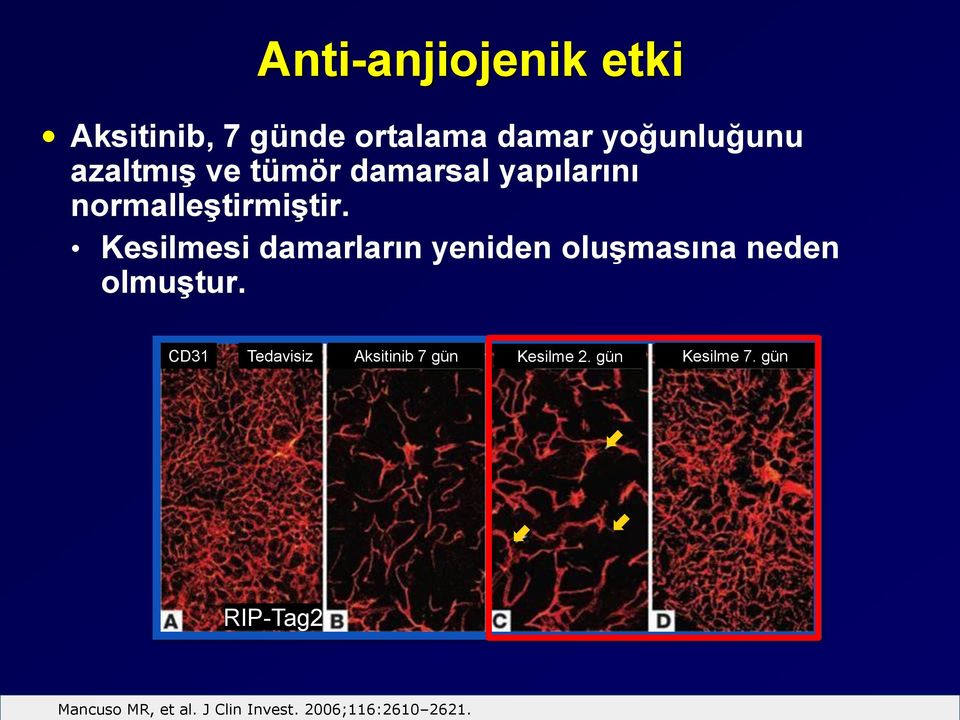 Kesilmesi damarların yeniden oluşmasına neden olmuştur.