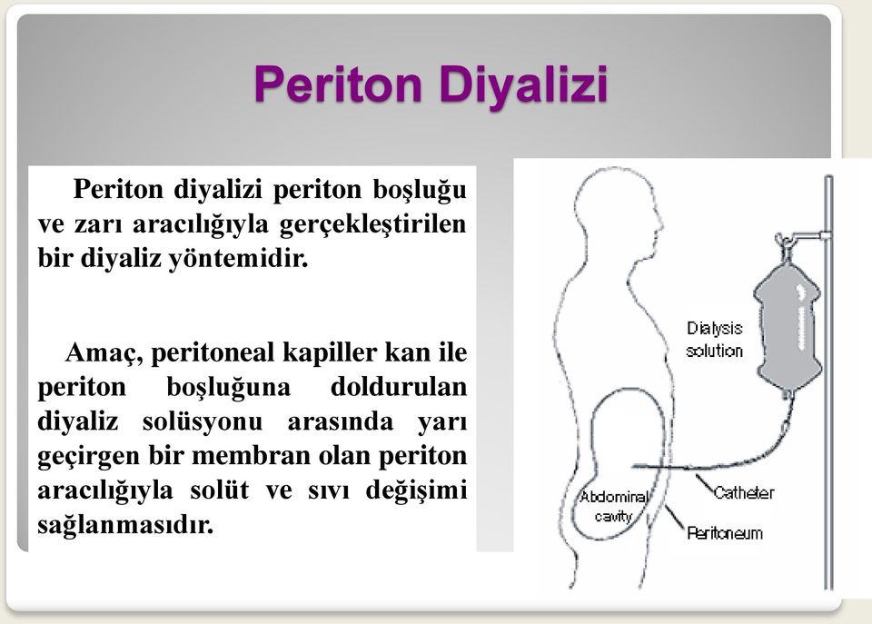 Amaç, peritoneal kapiller kan ile periton boşluğuna doldurulan diyaliz