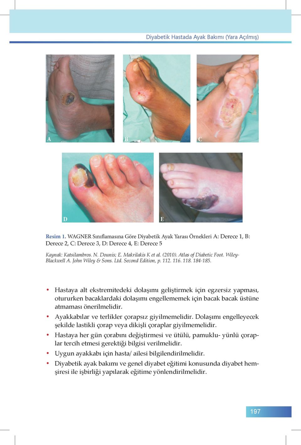 Atlas of Diabetic Foot. Wiley- Blackwell A. John Wiley & Sons. Ltd. Second Edition, p. 112. 116. 118. 184-185.