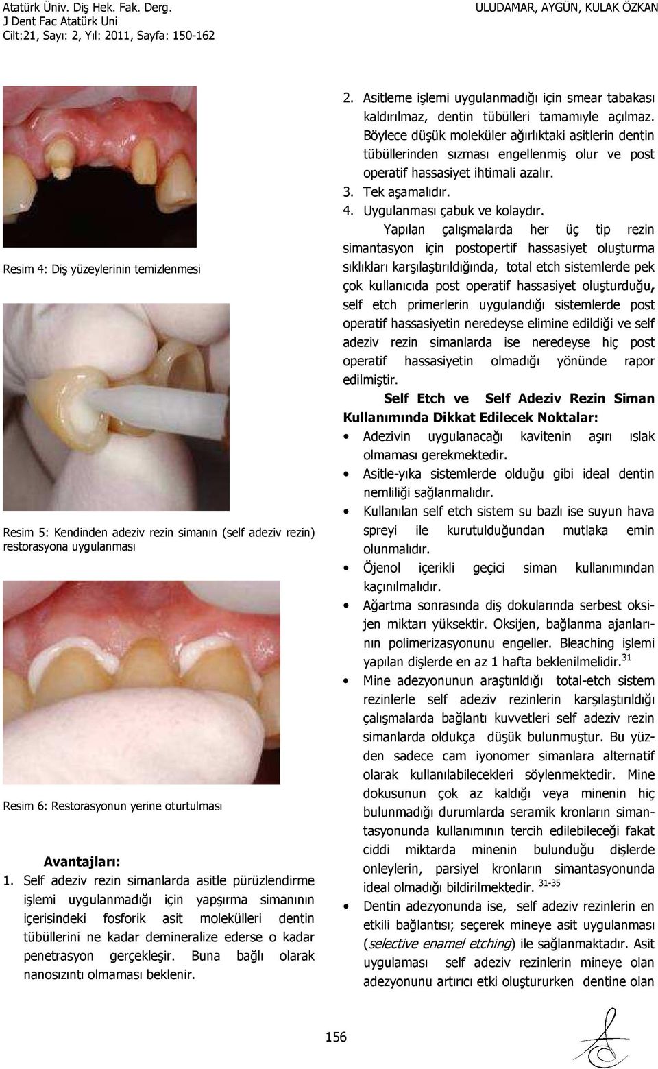 penetrasyon gerçekleşir. Buna bağlı olarak nanosızıntı olmaması beklenir. 2. Asitleme işlemi uygulanmadığı için smear tabakası kaldırılmaz, dentin tübülleri tamamıyle açılmaz.