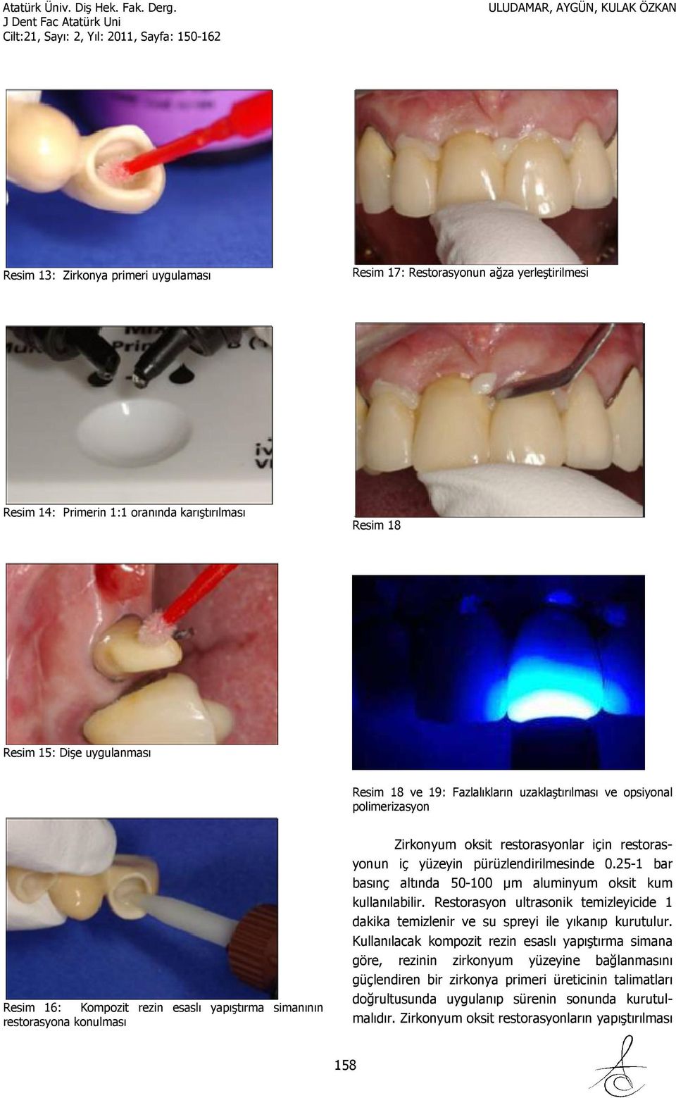 pürüzlendirilmesinde 0.25-1 bar basınç altında 50-100 µm aluminyum oksit kum kullanılabilir. Restorasyon ultrasonik temizleyicide 1 dakika temizlenir ve su spreyi ile yıkanıp kurutulur.