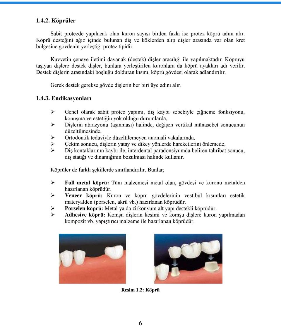 Kuvvetin çeneye iletimi dayanak (destek) dişler aracılığı ile yapılmaktadır. Köprüyü taşıyan dişlere destek dişler, bunlara yerleştirilen kuronlara da köprü ayakları adı verilir.