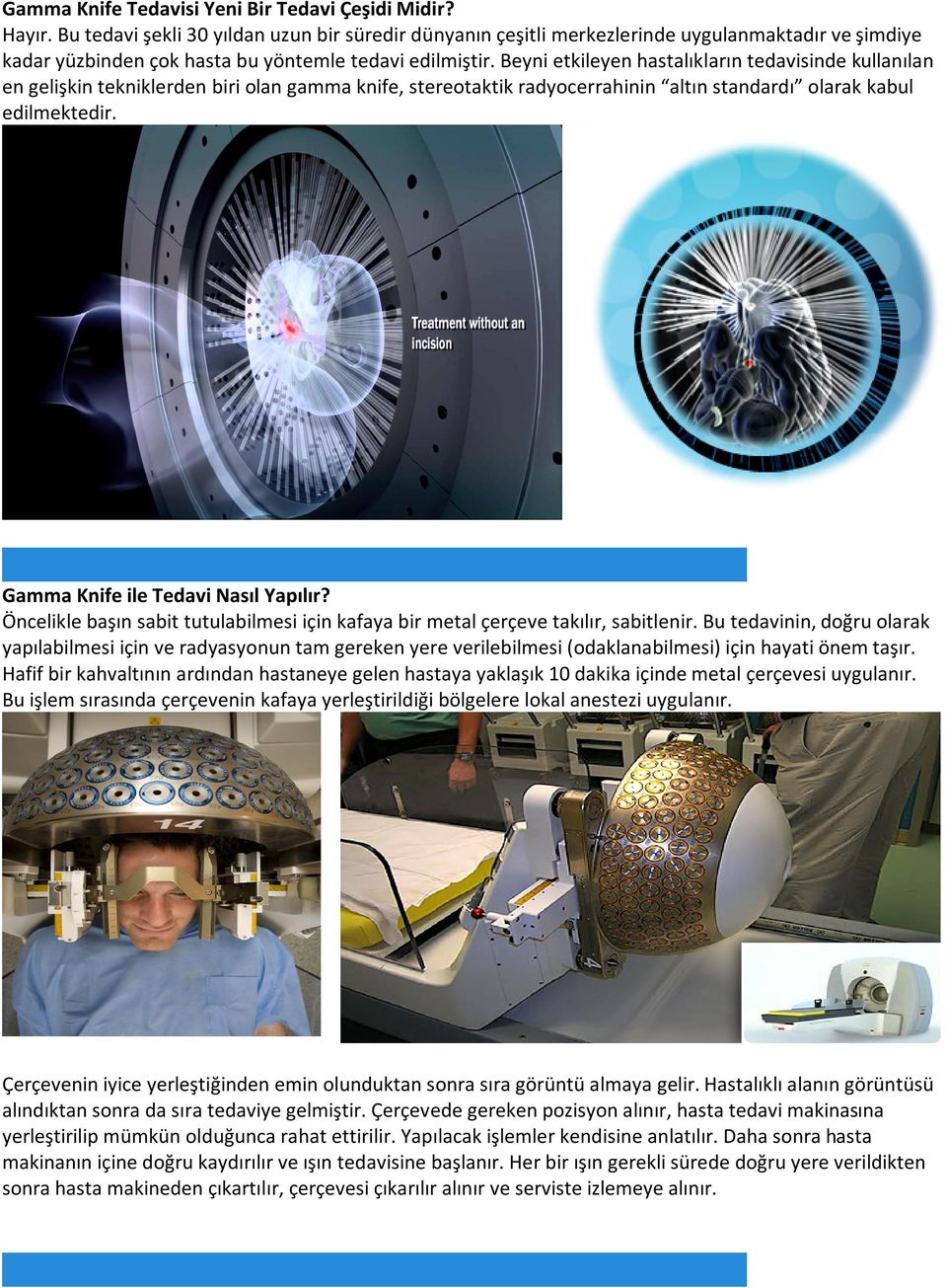 Beyni etkileyen hastalıkların tedavisinde kullanılan en gelişkin tekniklerden biri olan gamma knife, stereotaktik radyocerrahinin altın standardı olarak kabul edilmektedir.