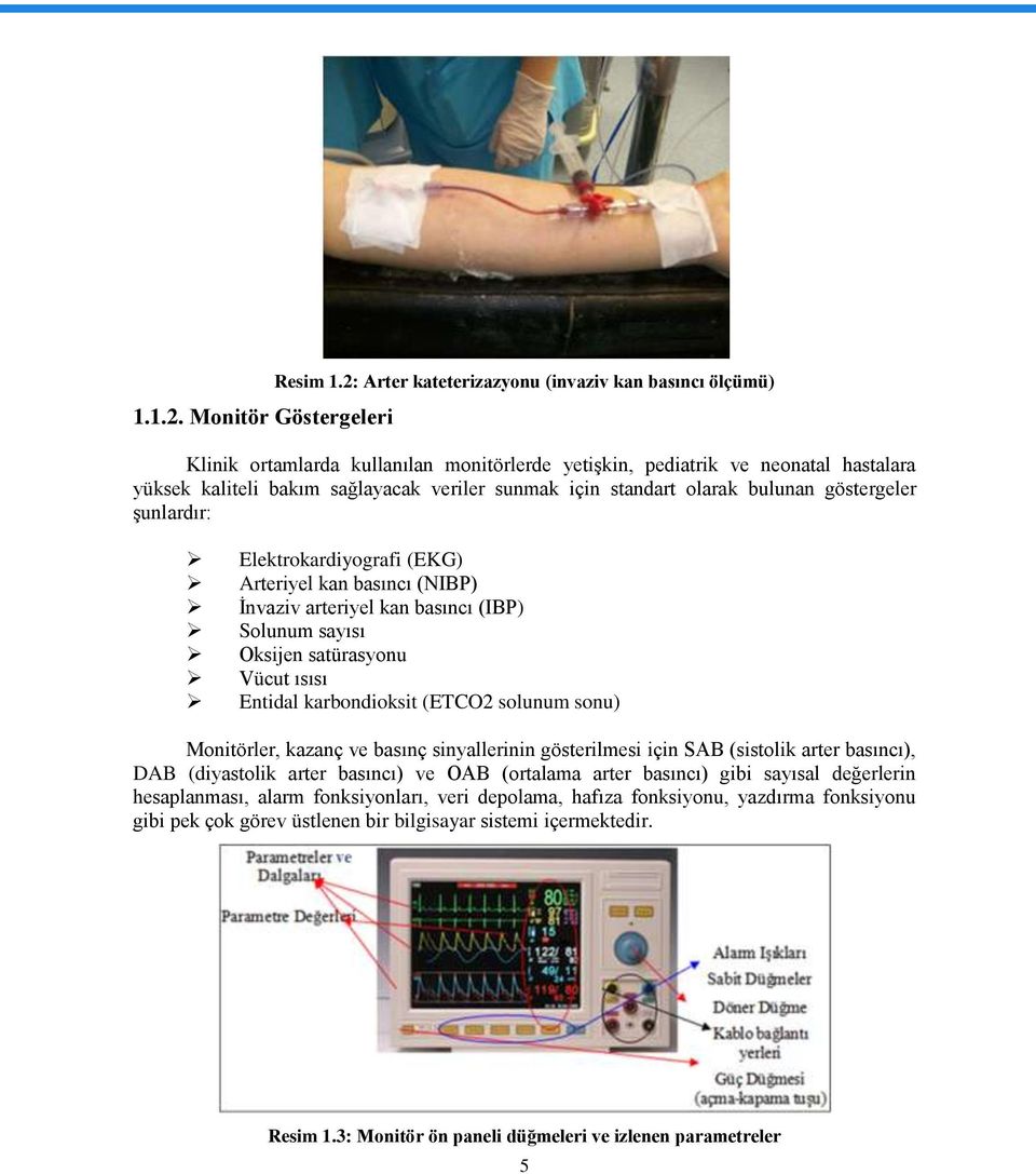 olarak bulunan göstergeler Ģunlardır: Elektrokardiyografi (EKG) Arteriyel kan basıncı (NIBP) Ġnvaziv arteriyel kan basıncı (IBP) Solunum sayısı Oksijen satürasyonu Vücut ısısı Entidal karbondioksit