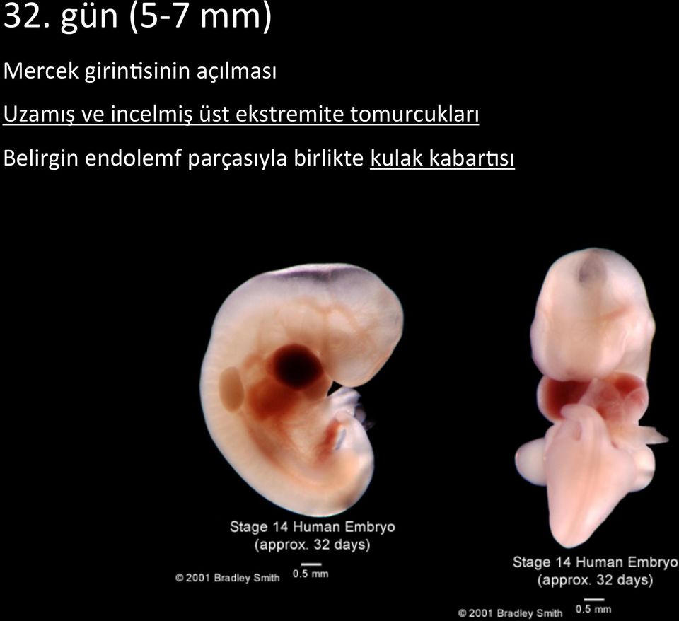 ekstremite tomurcukları Belirgin