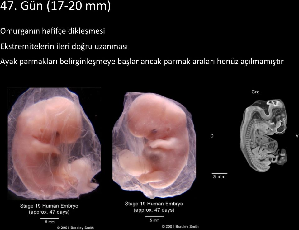 uzanması Ayak parmakları belirginleşmeye