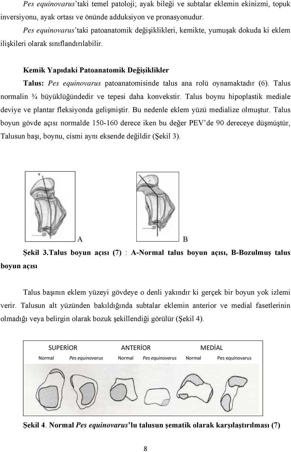 Kemik Yapıdaki Patoanatomik Değişiklikler Talus: Pes equinovarus patoanatomisinde talus ana rolü oynamaktadır (6). Talus normalin ¾ büyüklüğündedir ve tepesi daha konvekstir.