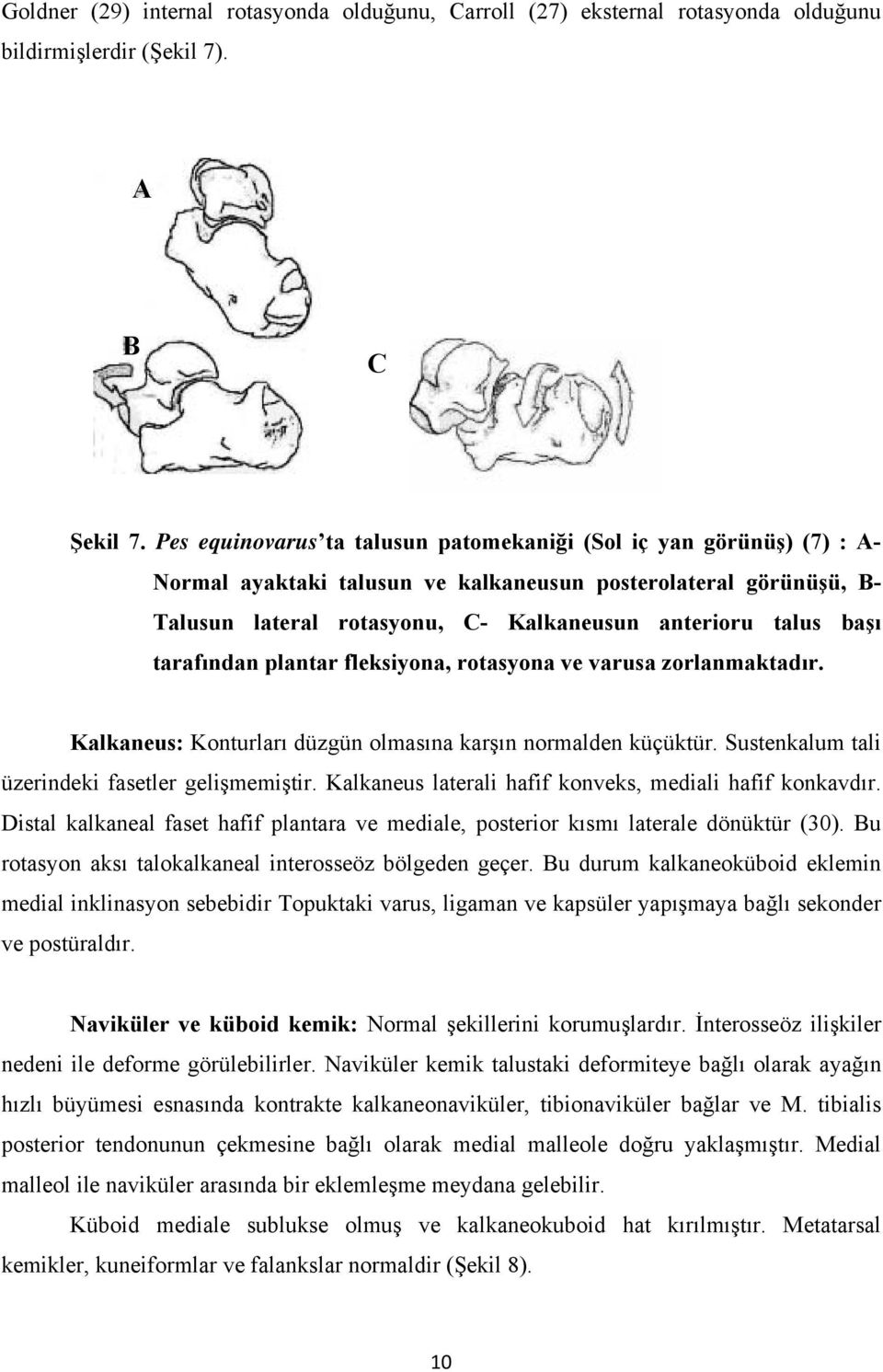 tarafından plantar fleksiyona, rotasyona ve varusa zorlanmaktadır. Kalkaneus: Konturları düzgün olmasına karşın normalden küçüktür. Sustenkalum tali üzerindeki fasetler gelişmemiştir.