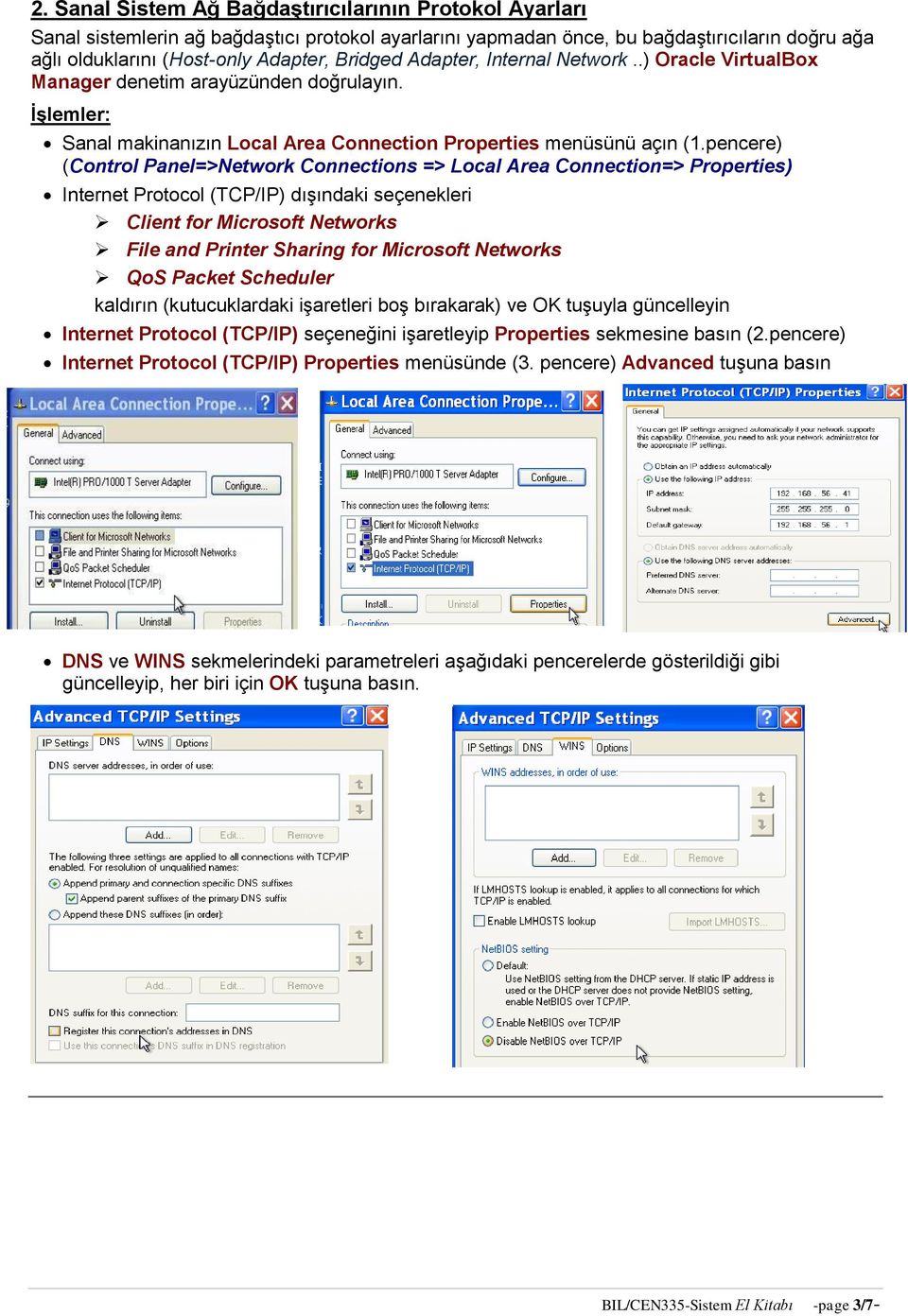 pencere) (Control Panel=>Network Connections => Local Area Connection=> Properties) Internet Protocol (TCP/IP) dışındaki seçenekleri Client for Microsoft Networks File and Printer Sharing for