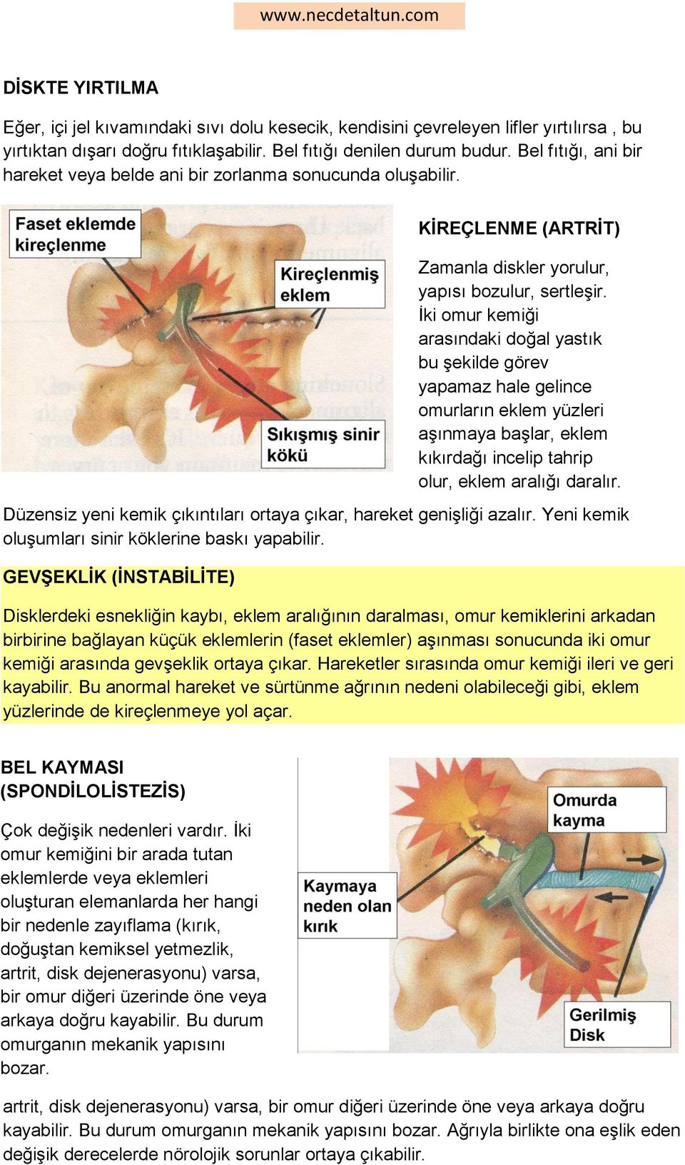 Yeni kemik oluşumları sinir köklerine baskı yapabilir. GEVġEKLĠK (ĠNSTABĠLĠTE) KĠREÇLENME (ARTRĠT) Zamanla diskler yorulur, yapısı bozulur, sertleşir.