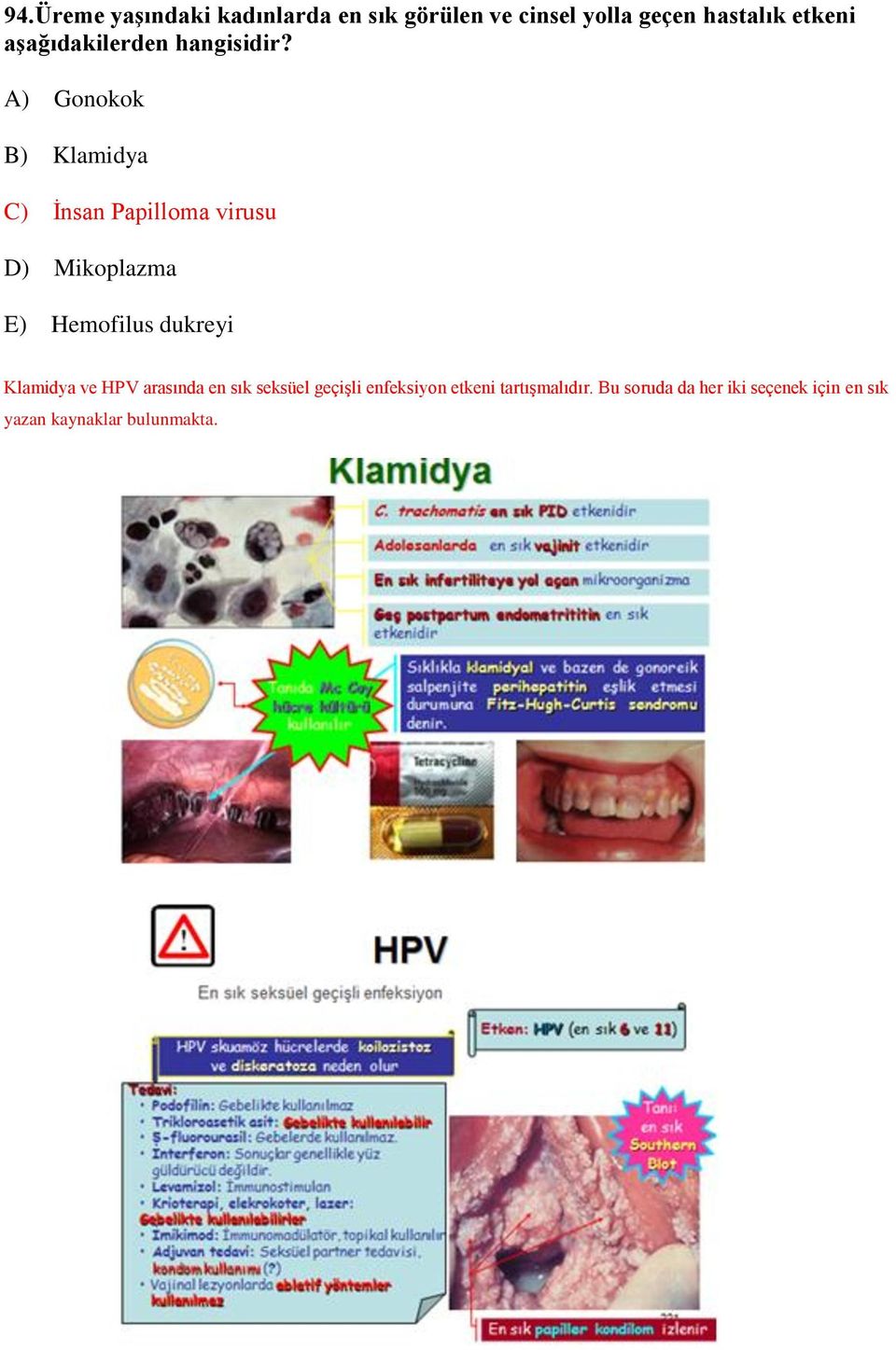 A) Gonokok B) Klamidya C) İnsan Papilloma virusu D) Mikoplazma E) Hemofilus dukreyi