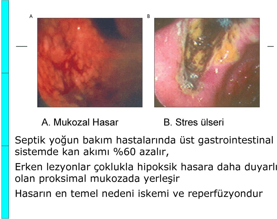 gastrointestinal sistemde kan akımı %60 azalır, Erken