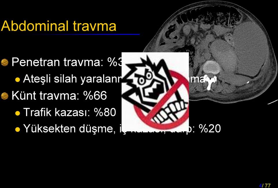 Künt travma: %66 Trafik kazası: %80