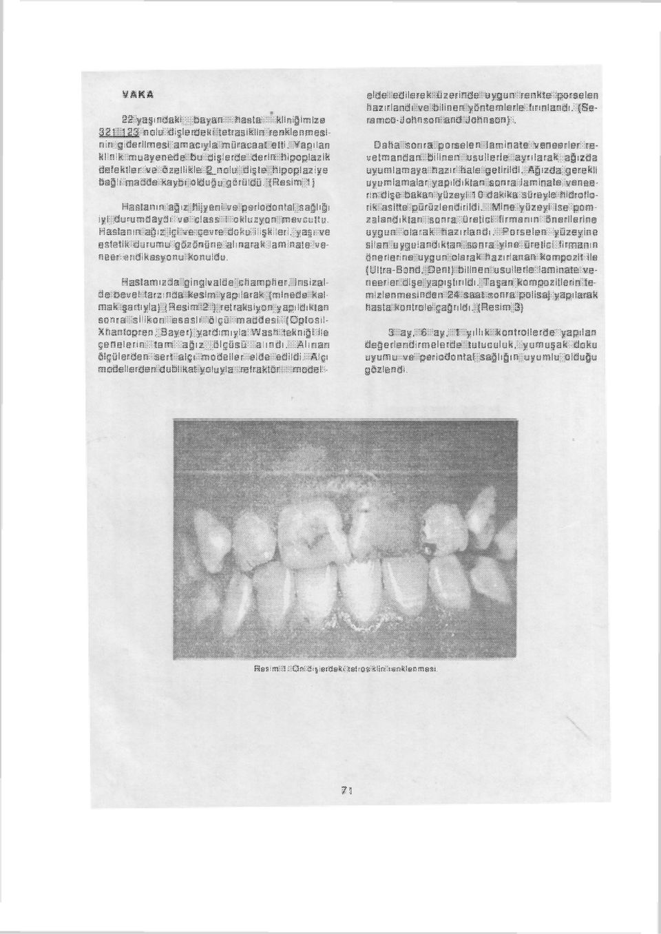 (Resim 1) Hastanın ağız hijyeni ve periodontal sağlığı iyi durumdaydı ve class t okluzyon mevcuttu.