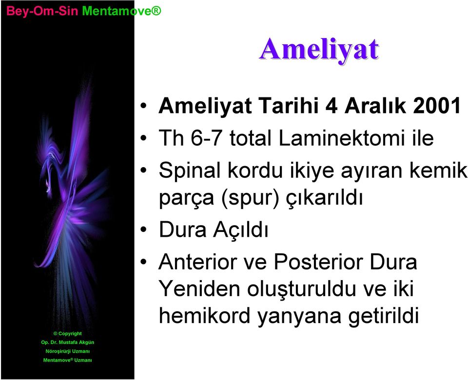 (spur) çıkarıldı Dura Açıldı Anterior ve Posterior