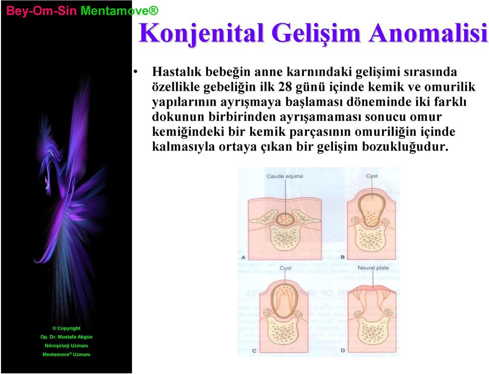 başlaması döneminde iki farklı dokunun birbirinden ayrışamaması sonucu omur