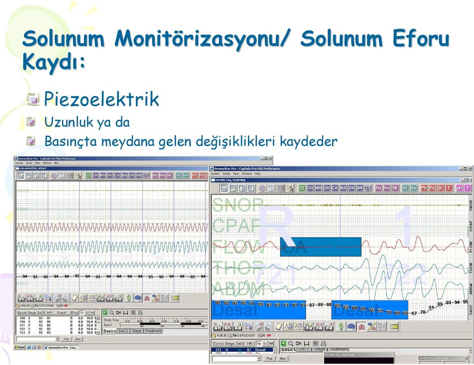 Kaydı: Piezoelektrik Uzunluk ya