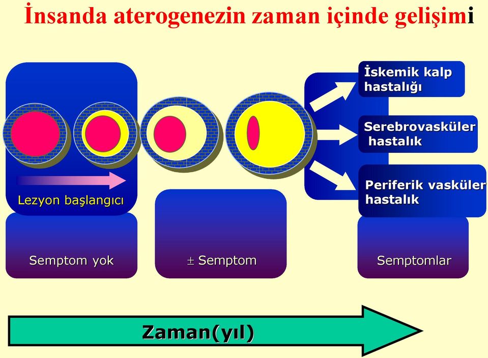 hastalık Lezyon başlangıcı Periferik