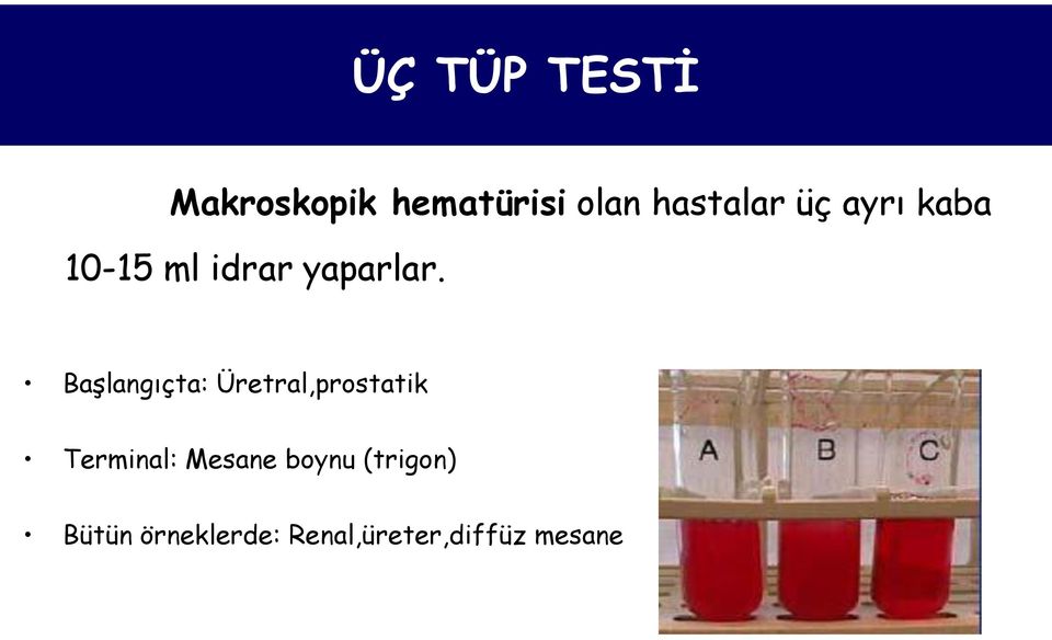 BaĢlangıçta: Üretral,prostatik Terminal: Mesane