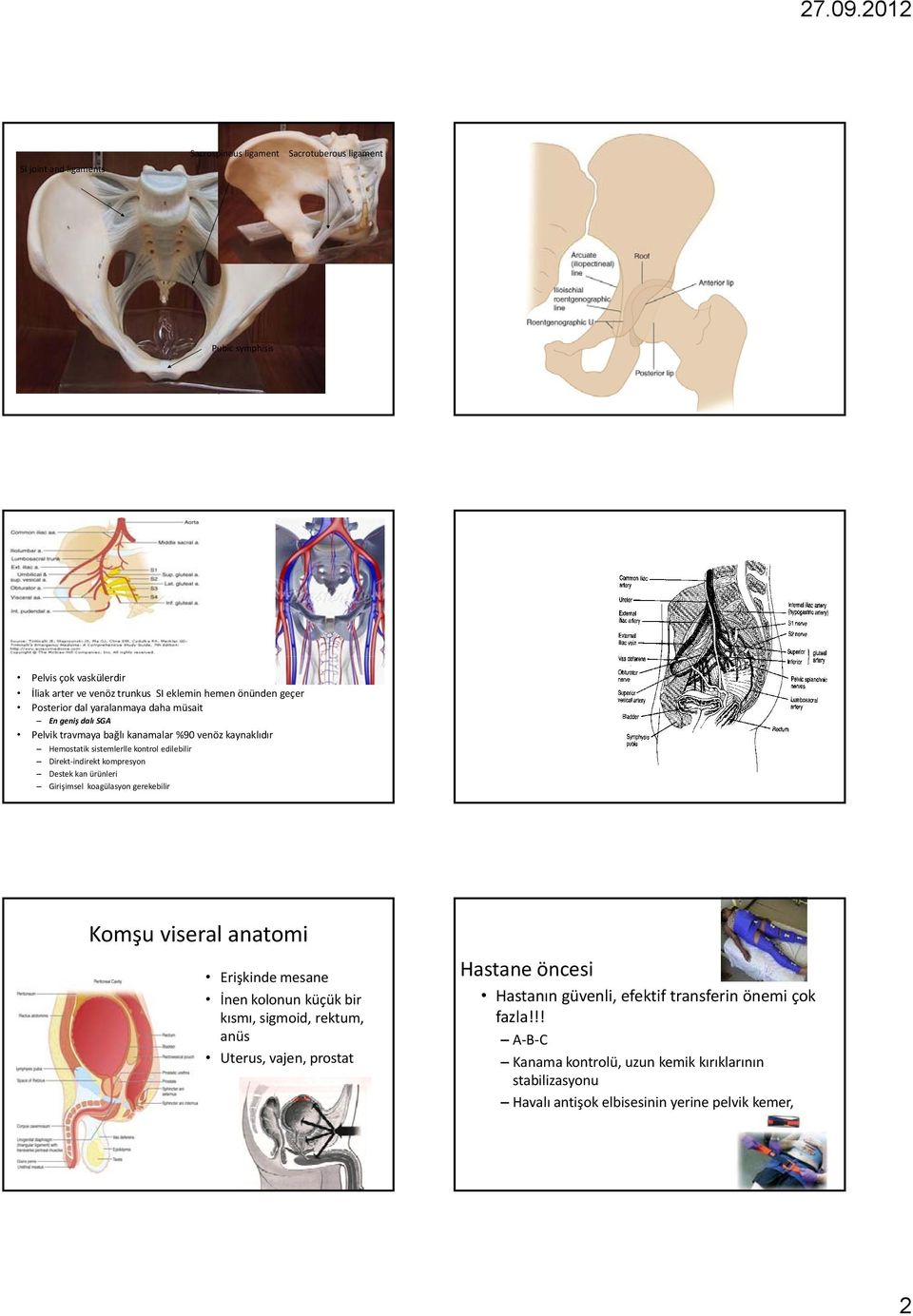 kompresyon Destek kan ürünleri Girişimsel koagülasyon gerekebilir Komşu viseral anatomi Erişkinde mesane İnen kolonun küçük bir kısmı, sigmoid, rektum, anüs Uterus, vajen,