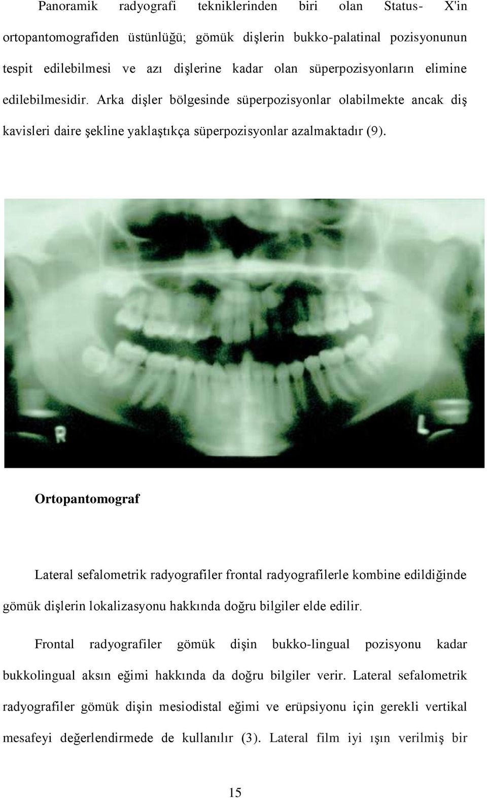 Ortopantomograf Lateral sefalometrik radyografiler frontal radyografilerle kombine edildiğinde gömük dişlerin lokalizasyonu hakkında doğru bilgiler elde edilir.