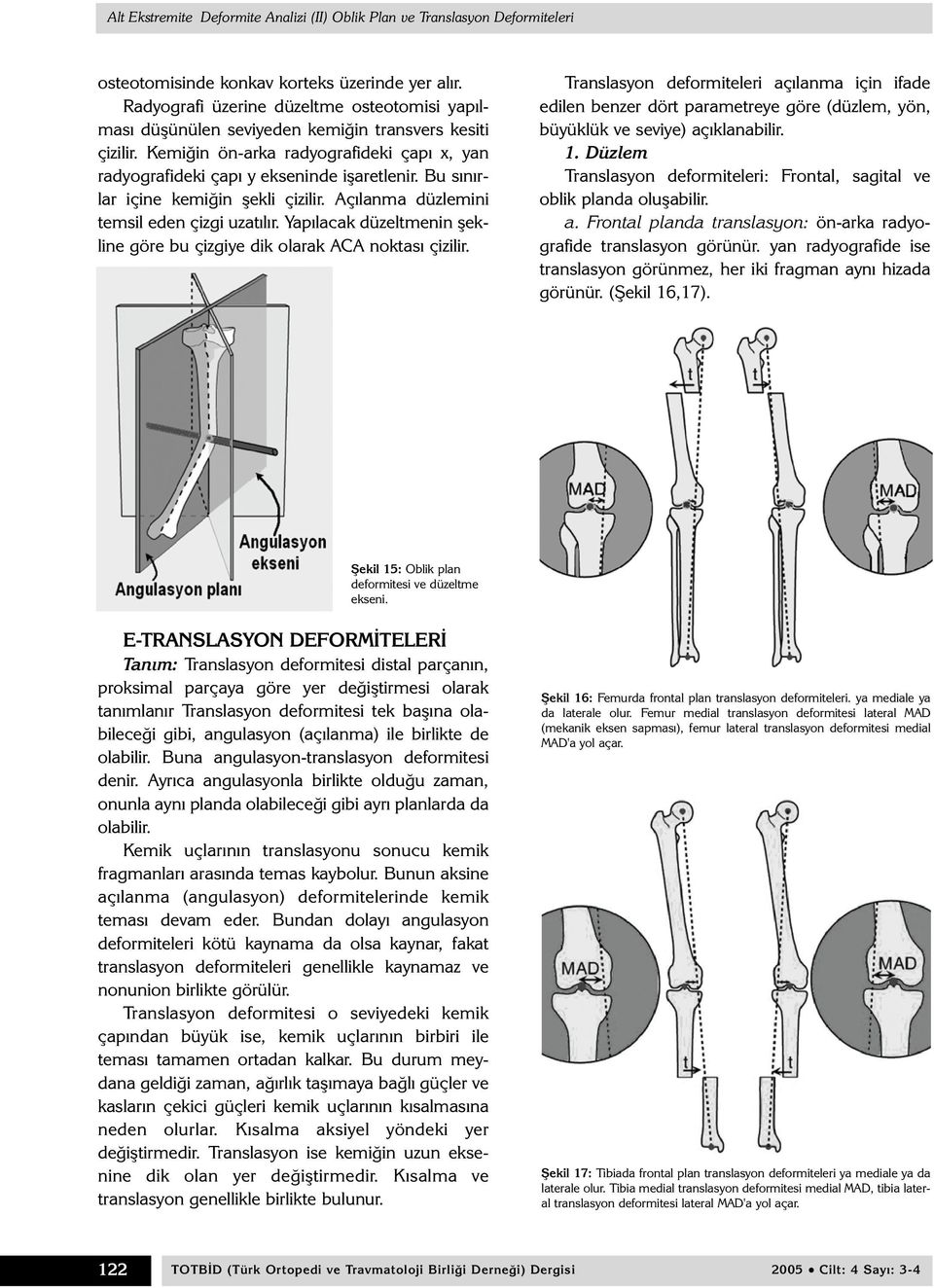 Yapýlacak düzeltmenin þekline göre bu çizgiye dik olarak ACA noktasý çizilir.