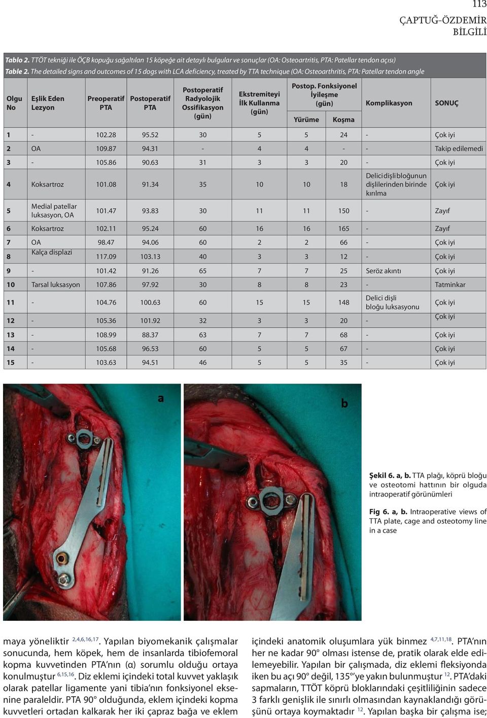 Postoperatif Radyolojik Ossifikasyon (gün) Ekstremiteyi İlk Kullanma (gün) Postop. Fonksiyonel İyileşme (gün) Komplikasyon SONUÇ Yürüme 1-102.28 95.52 30 5 5 24 - Çok iyi 2 OA 109.87 94.