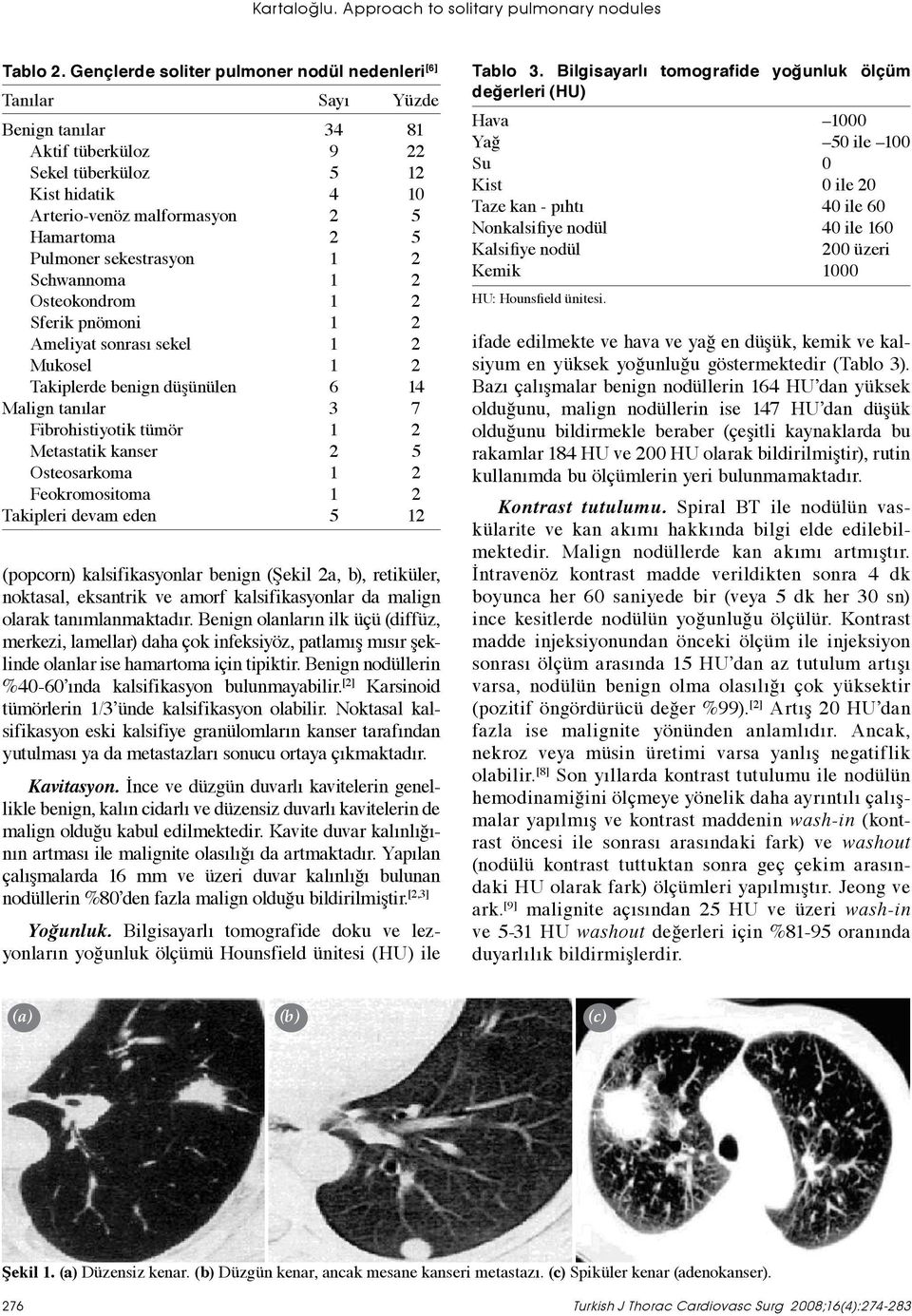 Pulmoner sekestrasyon 1 2 Schwannoma 1 2 Osteokondrom 1 2 Sferik pnömoni 1 2 Ameliyat sonrası sekel 1 2 Mukosel 1 2 Takiplerde benign düşünülen 6 14 Malign tanılar 3 7 Fibrohistiyotik tümör 1 2