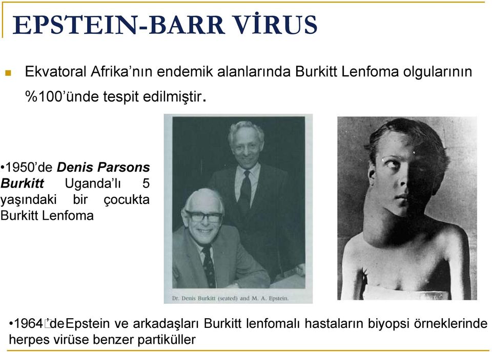 1950 de Denis Parsons Burkitt Uganda lı 5 yaşındaki bir çocukta Burkitt
