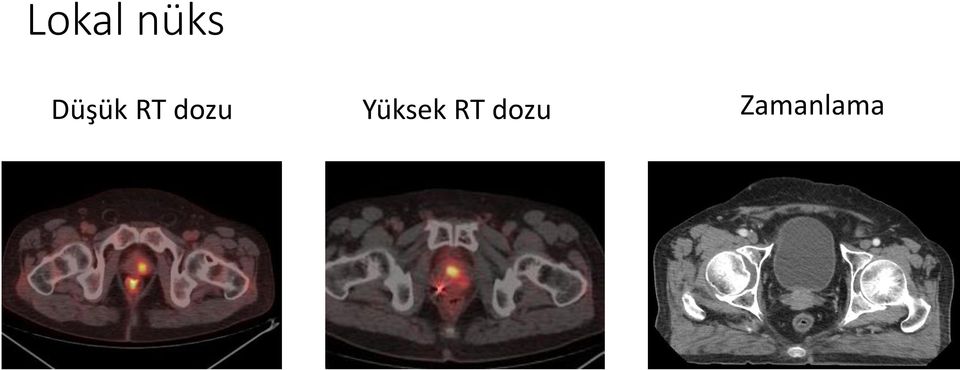 dozu Yüksek