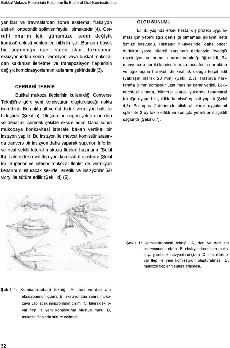 Bunların büyük bir çoğunluğu eğer varsa skar dokusunun eksizyonundan sonra, vermilyon veya bukkal mukozadan kaldırılan ilerletme ve transpozisyon fleplerinin değişik kombinasyonlarının kullanımı