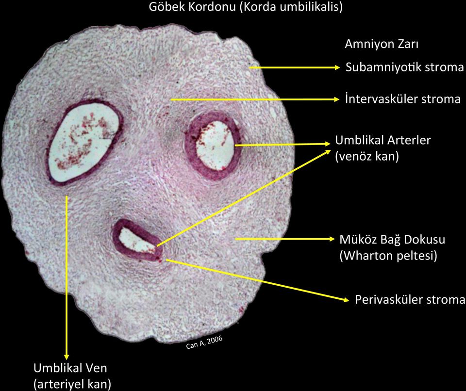 Arterler (venöz kan) Müköz Bağ Dokusu (Wharton