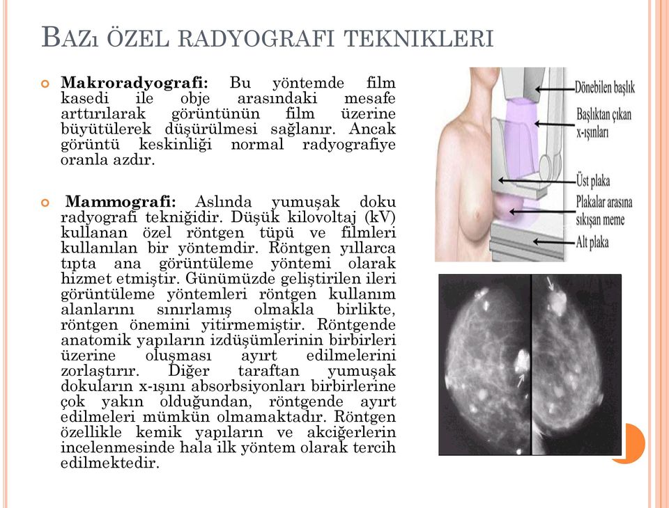 Düşük kilovoltaj (kv) kullanan özel röntgen tüpü ve filmleri kullanılan bir yöntemdir. Röntgen yıllarca tıpta ana görüntüleme yöntemi olarak hizmet etmiştir.