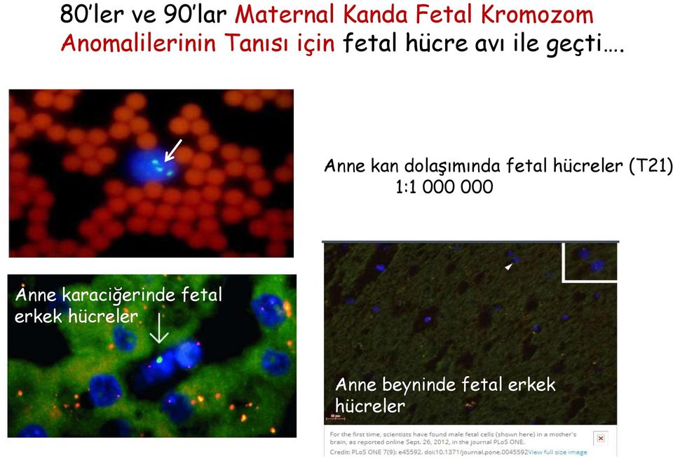 Anne kan dolaşımında fetal hücreler (T21) 1:1 000 000