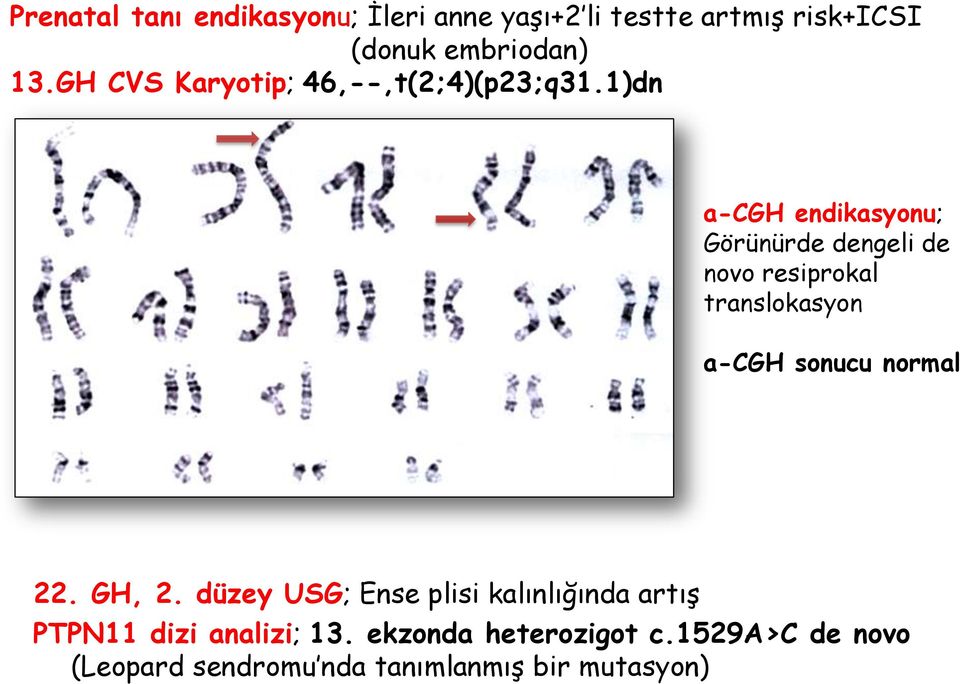 1)dn a-cgh endikasyonu; Görünürde dengeli de novo resiprokal translokasyon a-cgh sonucu normal