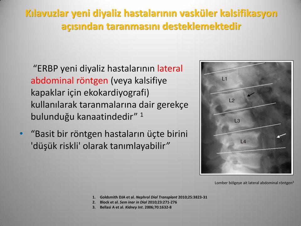 bir röntgen hastaların üçte birini 'düşük riskli' olarak tanımlayabilir Lomber bölgeye ait lateral abdominal röntgen 3 1.