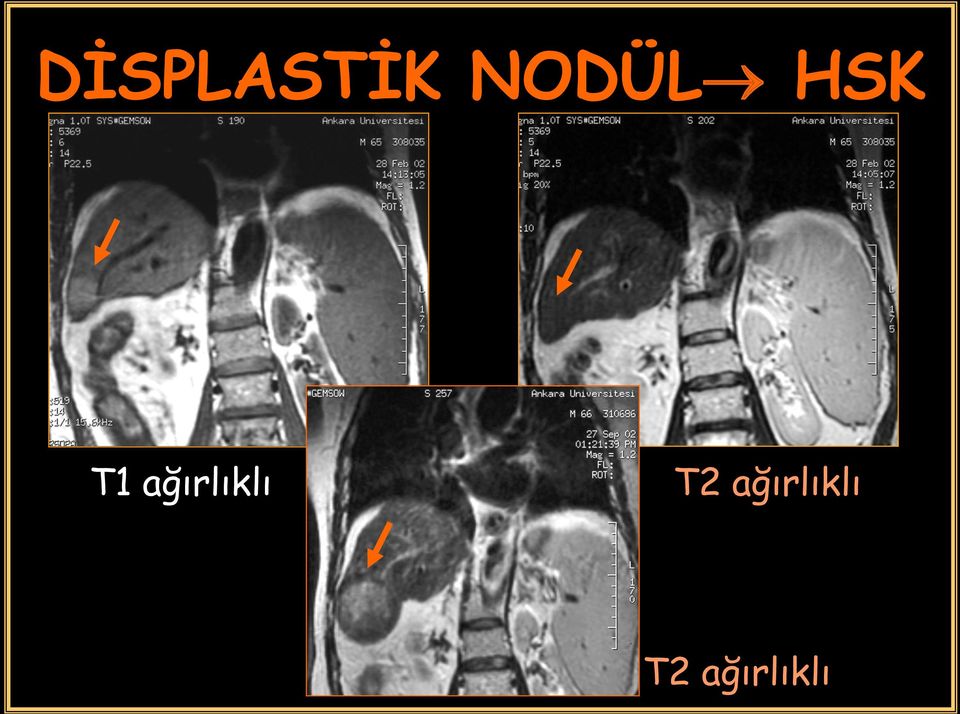 ağırlıklı T2